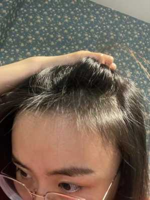 头发少怎么办啊（头发少怎么办啊女生）