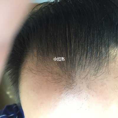 头发特别软,怎么能变硬,头发很软怎么变硬了