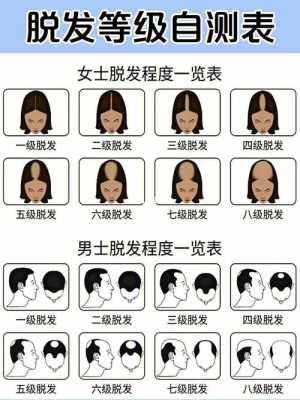 脱发的原因，脱发的治疗方法有哪些,脱发的主要原因是什么引起的