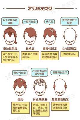 脱发的原因，脱发的治疗方法有哪些,脱发的主要原因是什么引起的