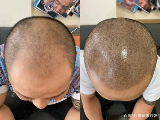 纹发是什么（纹发是什么原理）