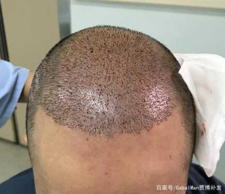 纹发是什么（纹发是什么原理）