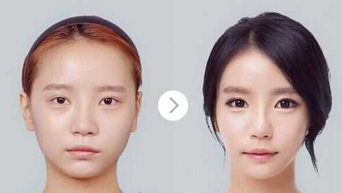 国字脸怎么变成瓜子脸（国字脸变成瓜子脸的成功案例）