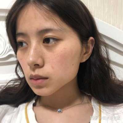 怎么使脸变圆（脸越变越圆润是咋回事啊）