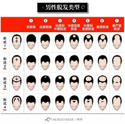 秃顶是为什么（秃顶是为什么引起的）