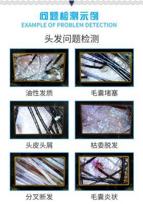 怎么检查头发（怎么检查头发毛囊是否闭合）