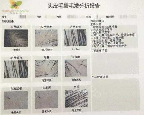 怎么检查头发（怎么检查头发毛囊是否闭合）