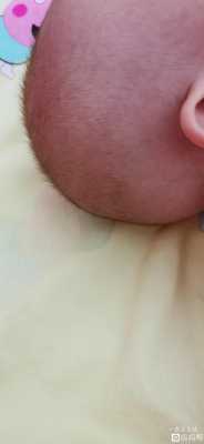 幼儿头发稀少怎么办（宝宝头发细软稀少怎么变粗）