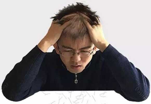 两边头发少是什么原因（两边头发少是什么原因引起的）