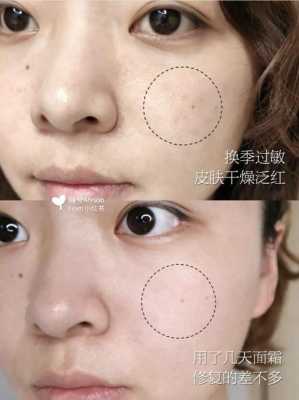 皮肤干化妆起皮怎么办（皮肤干化妆起皮怎么办啊）