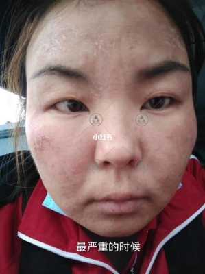 皮肤干化妆起皮怎么办（皮肤干化妆起皮怎么办啊）