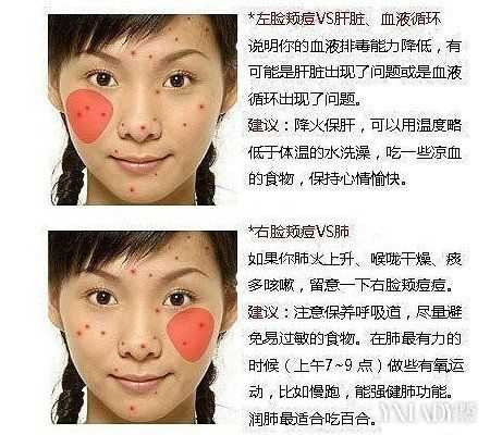 脸上长痘痘怎么快速去除,脸上长痘痘怎么快速去除?