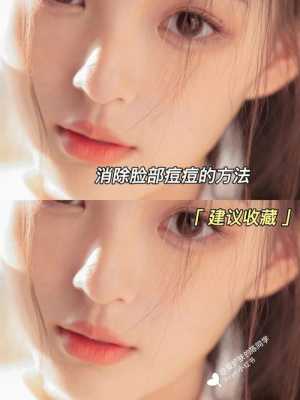 脸上长痘痘怎么快速去除,脸上长痘痘怎么快速去除?