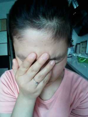 为什么头发很多但长不长,头发不怎么长是什么原因造成的