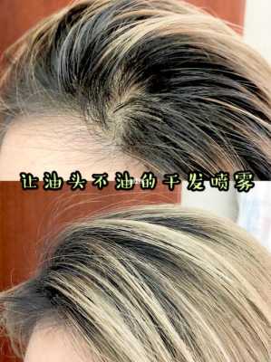 前面头发容易油怎么办,头发老是油油的怎么办啊