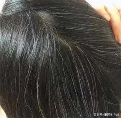 长白头发缺少什么营养（儿童长白头发缺少什么营养）