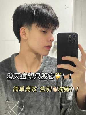 男士怎么祛痘（男士怎么祛痘印）