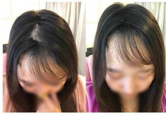头发没有怎么办（头发没有怎么办女生）