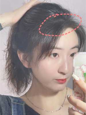 发际线碎发太多怎么办（头发发际线碎发多怎么办）
