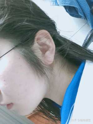 鬓角头发多怎么办（鬓角头发多怎么办女）