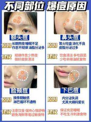 怎么样快速消除痘痘（怎么样快速消除痘痘红肿）