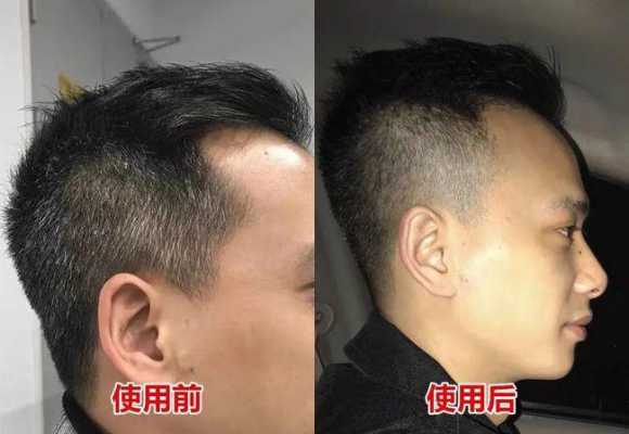 用什么染白发（染白发教程）