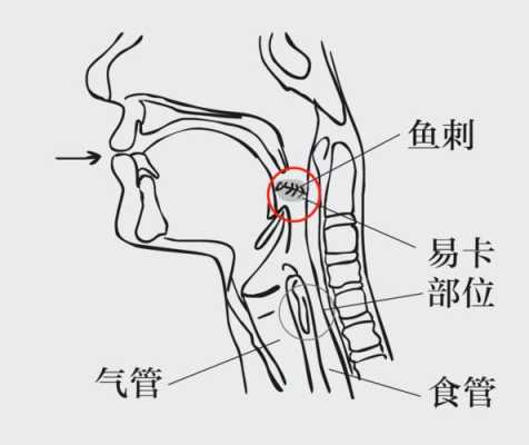 鱼刺怎么发（鱼刺怎么发制）