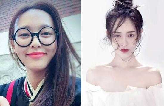 女生额头秃适合什么发型,前额秃头适合什么发型女