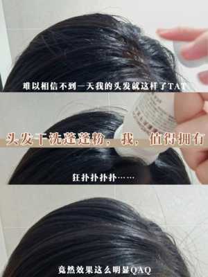 额头脏怎么处理,额头怎么洗额头的