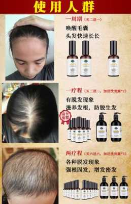 怎么防止脱发,什么东西可以防止脱发生发