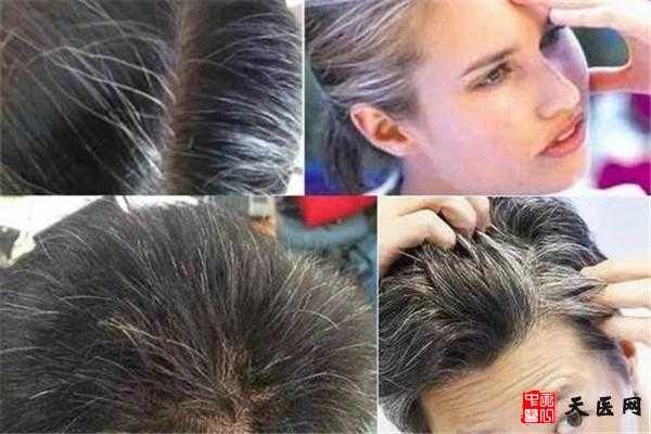 头发爱油怎么回事啊（为什么有人头发油的不快）