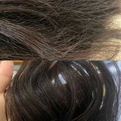 头发掉的厉害，用发膜可以解决吗,秋天掉发严重怎么办扎头发有点痛