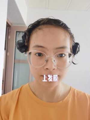 头发掉的厉害，用发膜可以解决吗,秋天掉发严重怎么办扎头发有点痛