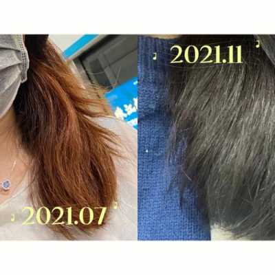 头发掉的厉害，用发膜可以解决吗,秋天掉发严重怎么办扎头发有点痛