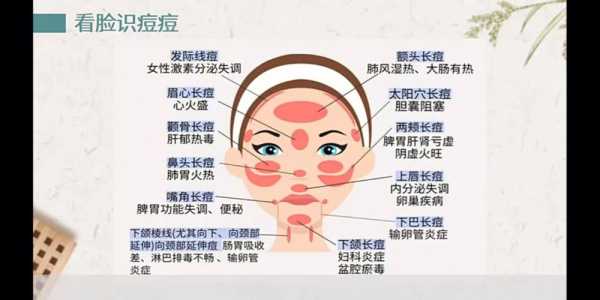 脸上起痤疮怎么治疗（脸上起痤疮怎么治疗最有效）