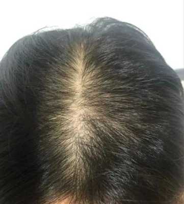 为什么我的头发吹完很软,头发变软了是什么原因造成的