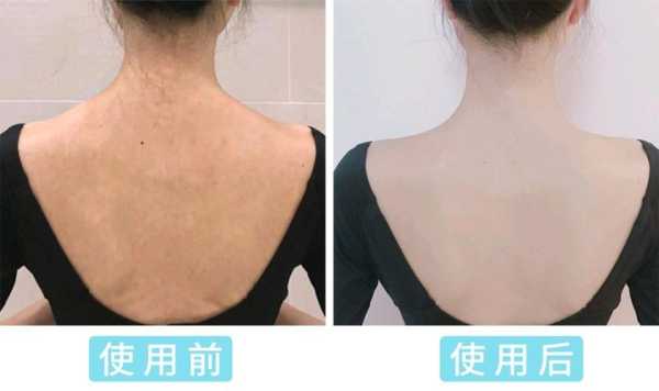 后背黄怎么变白,黄皮肤怎么美白最简单的
