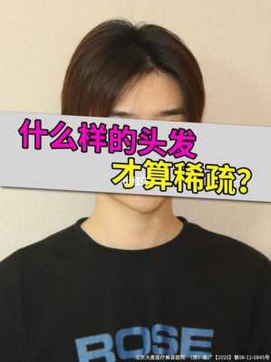 头发变稀怎么回事（头发稀怎么办）