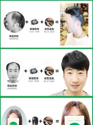 织发、种植头发、假发是一样的吗,什么地方可以种头发呢