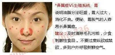 鼻子长痘是什么原因,鼻子上为什么会长痘痘又红又肿