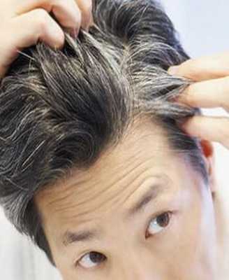为什么会有青少年有白头发,青少年为什么有白头发,怎样治