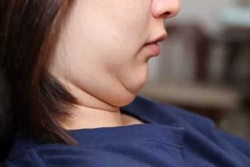 中年女性脸颊如何胖起来,脸颊怎么胖起来