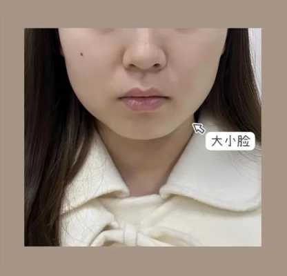 中年女性脸颊如何胖起来,脸颊怎么胖起来