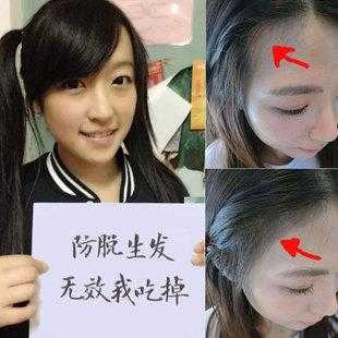 头发怎么变密（怎样让头发变多变密自然方法）