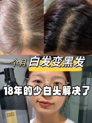 如何去白头发,怎么治头发白的好办法