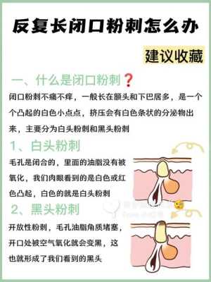 去除粉刺闭口的方法,怎么祛闭口粉刺小妙招视频
