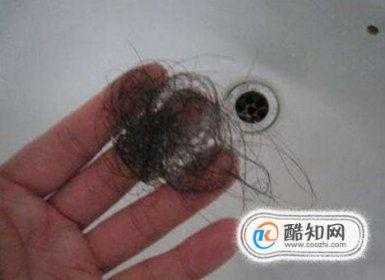 头发掉的好厉害怎么办（头发掉的厉害怎么治）