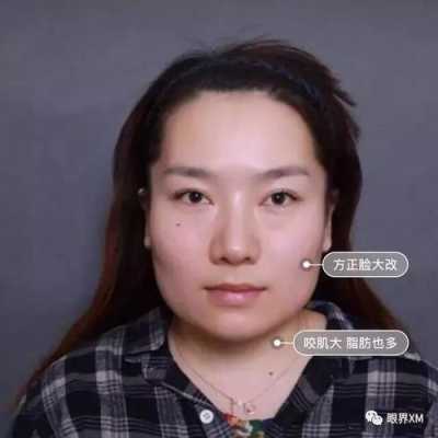 为什么脸型越来越方（别人说我脸方怎么回应）