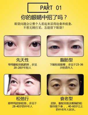 眼袋大怎么去（眼袋大怎么去除最有效果）