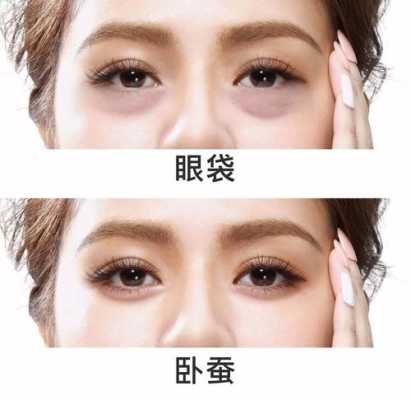 眼袋大怎么去（眼袋很严重，如何消除眼袋）
